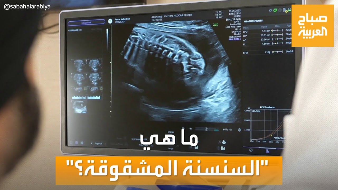 صباح العربية | 