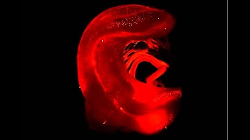 3D reconstruction and animation of the hippocampus from a GFP-M mouse.