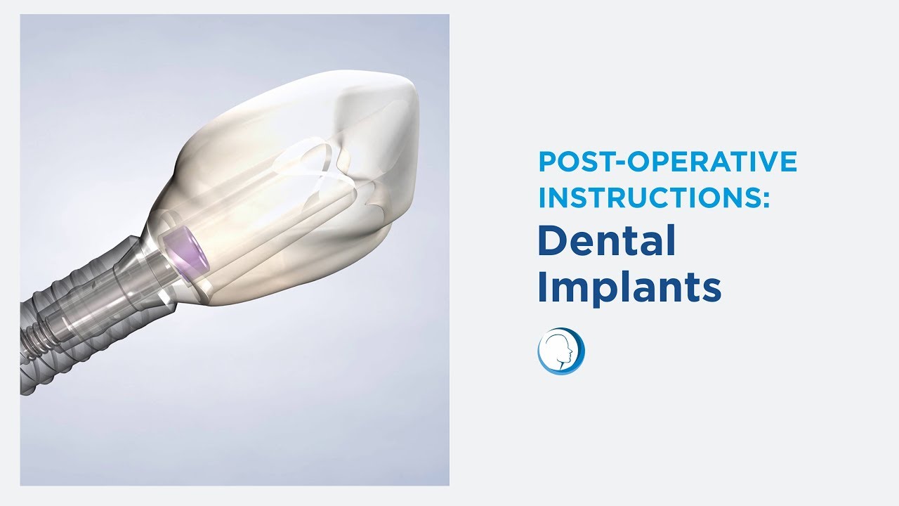 PostOp Dental Implants at Roden Oral, Facial, and Dental Implant