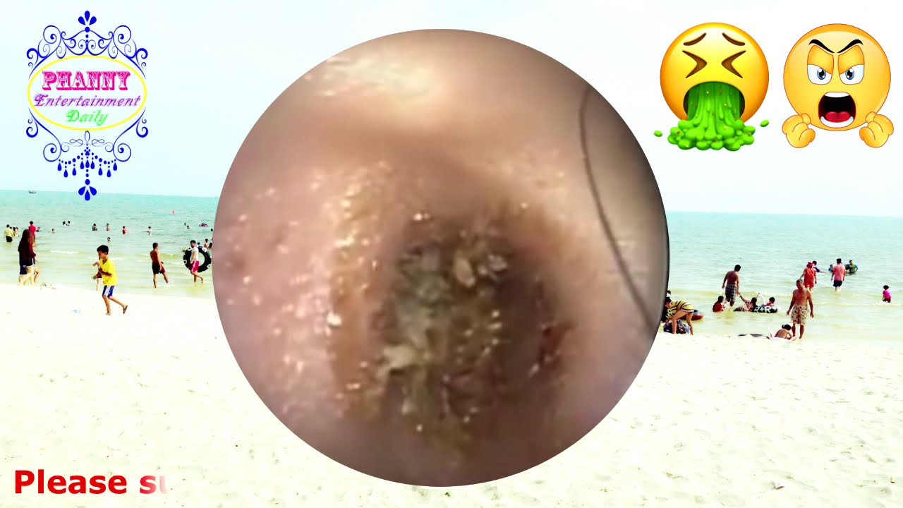 It's good for your ear health | Every thing will be better than before # 11 - YouTube