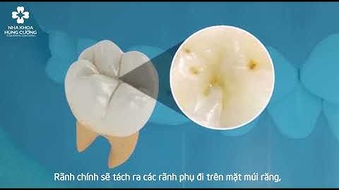 NKHC - Tại Sao Trẻ Hay Đau Răng Và Cách Điều Trị