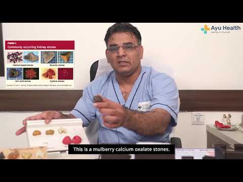 Video: Types of kidney stones