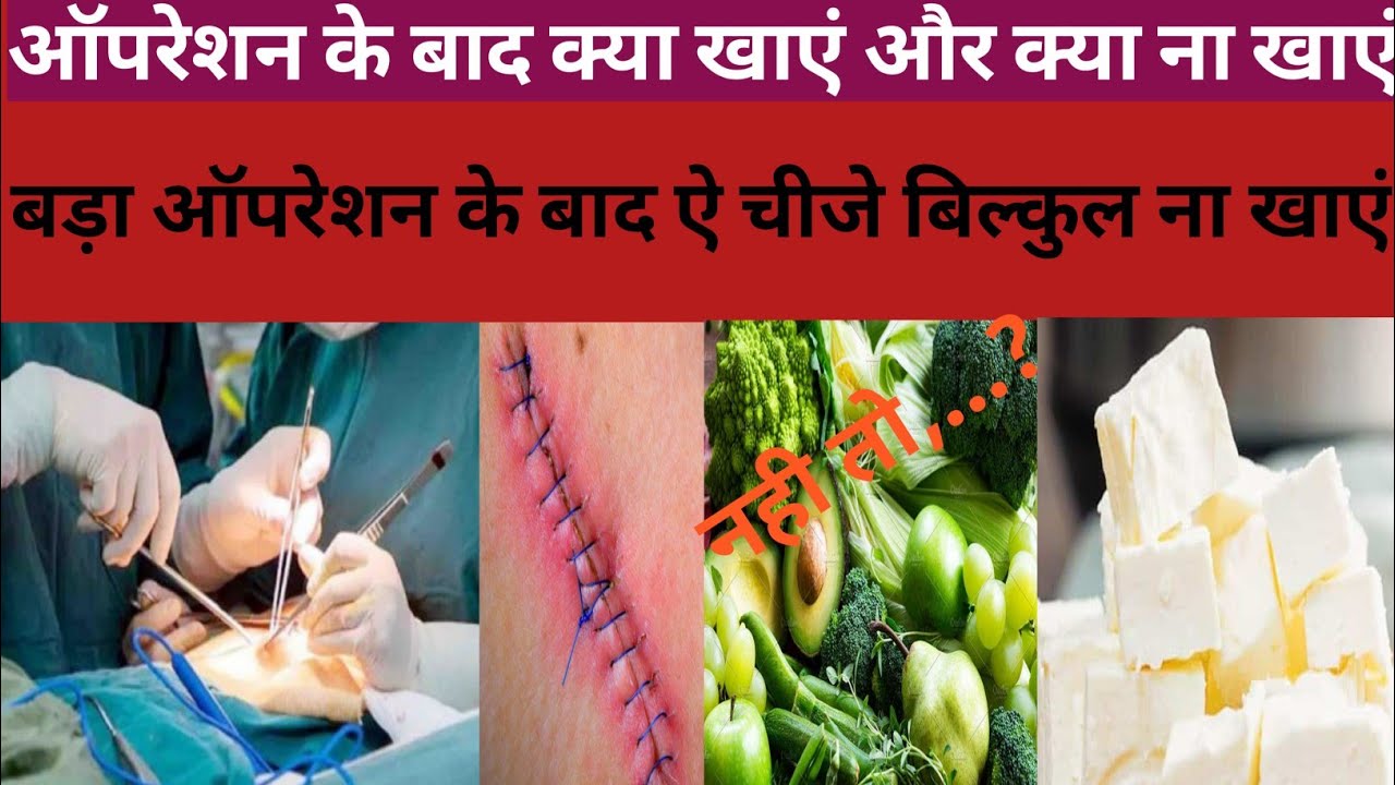ऑपरेशन के बाद क्या खाना चाहिए और क्या नही खाना चाहिए Opration ke bad ...