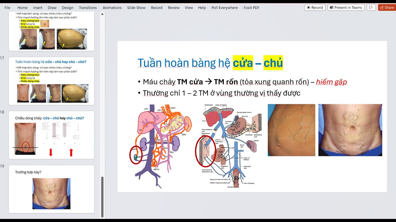 Khám phân biệt 3 nhóm TUẦN HOÀN BÀNG HỆ | Đình Đình