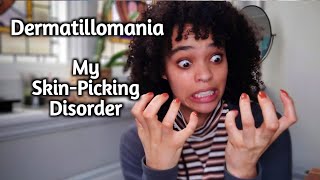 I Have Dermatillomania  My Skin Picking Disorder