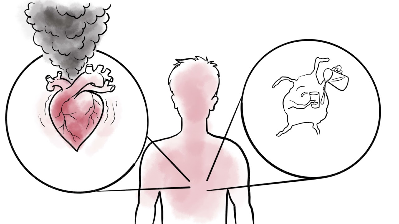 Gene Therapy for Friedreich's Ataxia