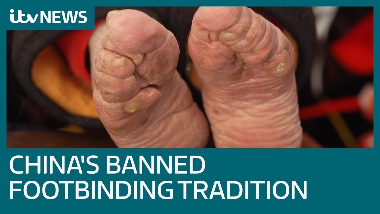 Banned Practice Of Foot Binding Blighting China S Oldest Women Itv News Youtube