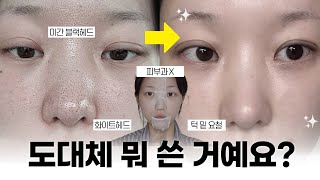 피부과 안 가도됨🙆🏻‍♀️ '홈케어' 만으로 10분만에 요철+피지 박멸하는 법 🍯 (+관리 후 꿀템까지 !) | 소윤Soyoon