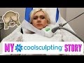 COOLSCULPTING MY CHIN: FOLLOW ME & ALL YOUR QUESTIONS ANSWERED!!