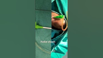 Thumbnail of angiography 🫀 | angio heart problems 💊| cardiology 🫀#heart #angiogram #shotsfeed @Utype197 #viral