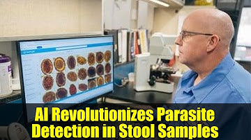 AI Revolutionizes Parasite Detection in Stool Samples