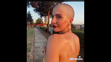 صور قدر بطله مسلسل الازهار الحزينه قبل ماتحلق شعرها وبعد ماحلقته 