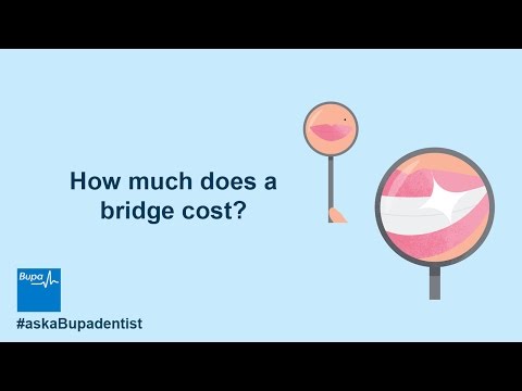 Videó: Mennyibe kerül egy híd újjáépítése?