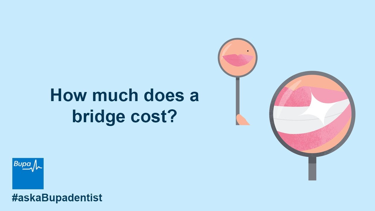 How much does a bridge cost?