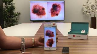 DermEngine Apple TV App