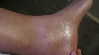 HOW TO GET SOFT FEET IN ONE DAY/NAMNA YA KUWA NA NGOZI NZURI YA MIGUU NA VITU UNAVYOTAKIWA KUTUMIA. screenshot 4