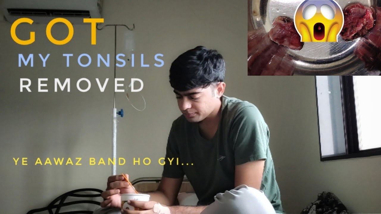 my tonsil surgery awaz band ho gyi... 🥲|Rahul Bharadva Vlogs|