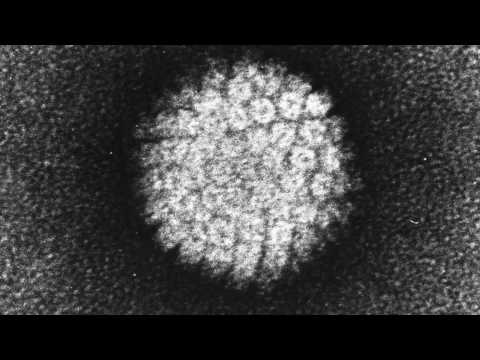 Vidéo: 3 façons de tester le VPH