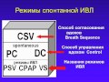 Режимы ИВЛ 4, раскладываем по полочкам