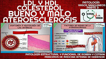 ¿Cómo se rompe la aterosclerosis?