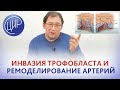 Плацентация. Инвазия трофобласта и ремоделирование спиральных артерий - в чём разница. Гузов И.И.