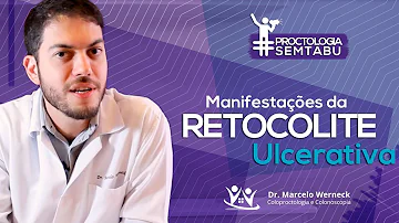 Como é feito o diagnóstico da retocolite ulcerativa?