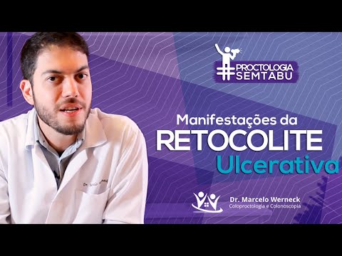 Quais são os sintomas da Retocolite Ulcerativa? | Dr. Marcelo Werneck