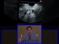 Diagnóstico Detalhado  Tuba Uterina Ectasiada e Doente