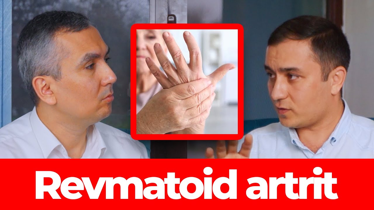 Revmatoid artritda garmon ichish | Mirziyod Mirhamidov
