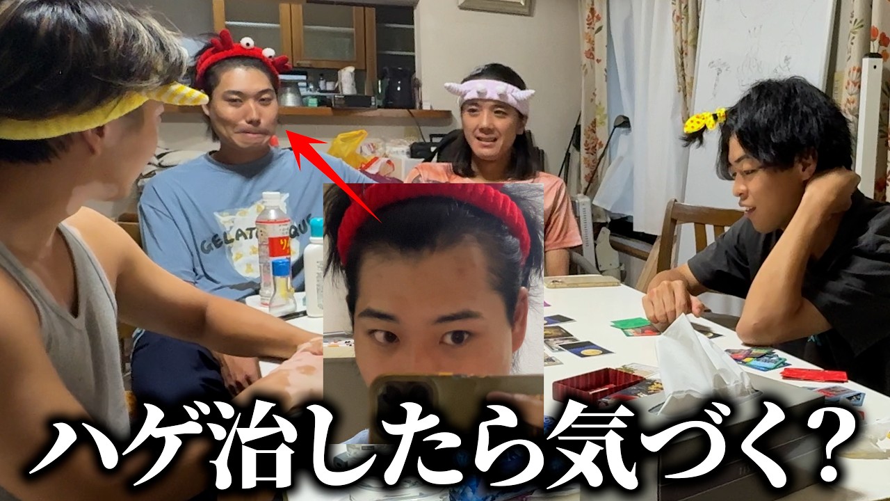 【検証】ハゲを少しずつ治してったら同居人はいつ気づくのか！？