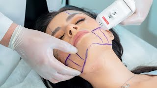 Daniela Loera Prueba El Hifu Testimonial Para Be You