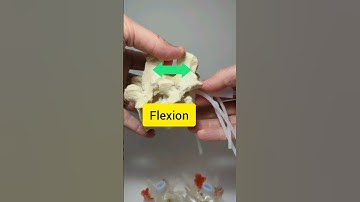 Unlocking Lumbar Flexion: Alleviating Spinal Stenosis with Dynamic Disc Models
