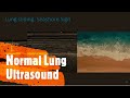 Normal Lung Ultrasound. Perioperative & Critical Care POCUS