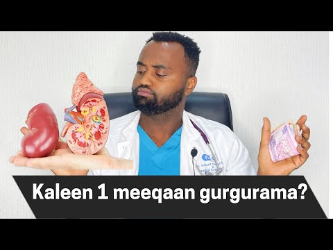 Kaleen Qarshii Meeqaan Gurgurama Eessatti Gurgurama