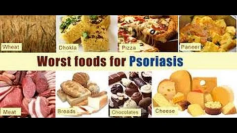 WORST FOODS FOR PSORIASIS!!