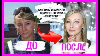 видео: До и после пластики и косметологии. О чем я жалею. картинка: До и после пластики и косметологии. О чем я жалею.