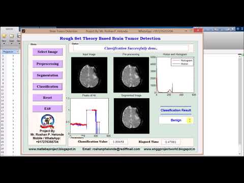 Brain Tumor Detection using Rough Set Theory Matlab Source Code