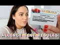 MY ALLERGY TEST RESULTS 😱 18 THINGS!