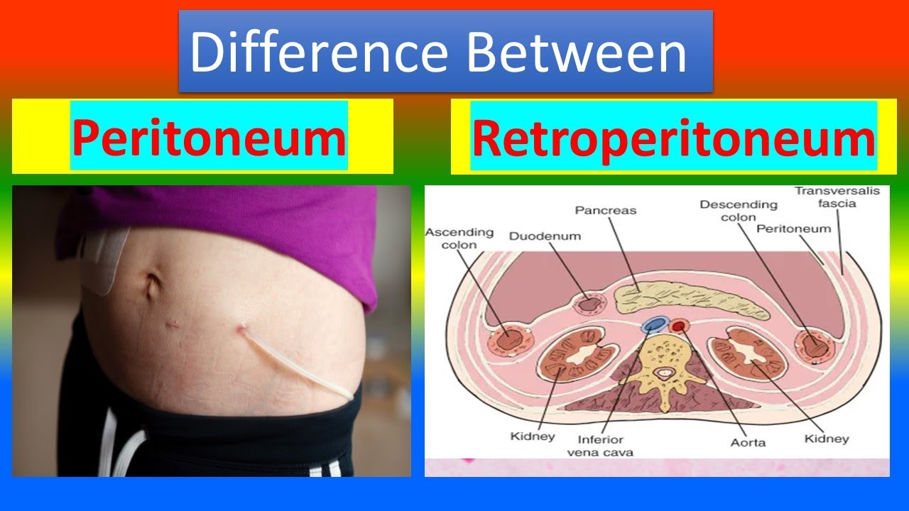 Difference Between Peritoneum And Retroperitoneum YouTube