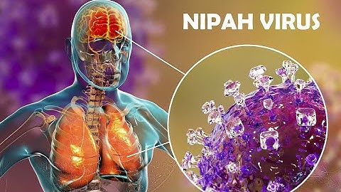 Nipah Virus: The Silent Killer from India