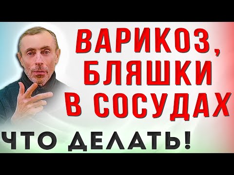 Варикоз, Бляшки в Сосудах - Что Делать! Болят ноги, воспаление