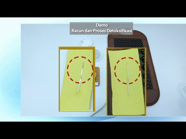 Happy Dream Indonesia Infomercial diabetes warm pad germanium bagian 2 class=