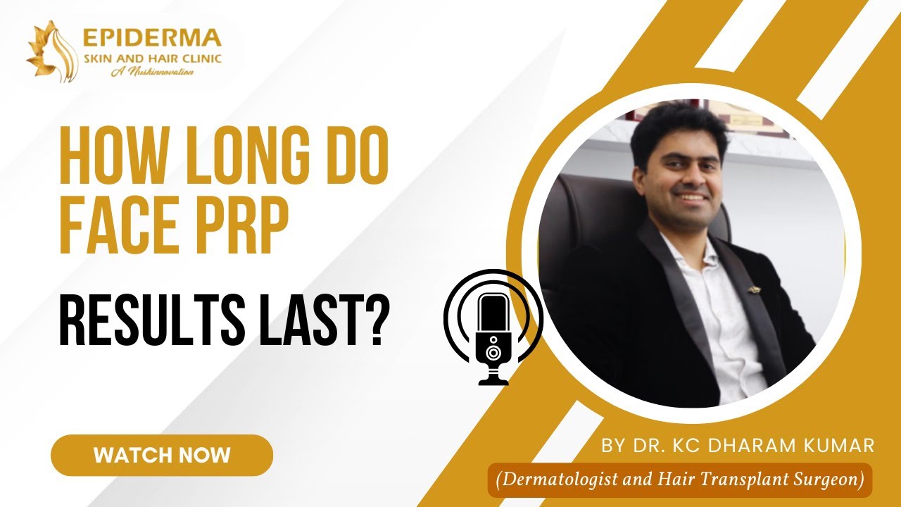 How Long Do Face PRP Results Last?| Dr. KC Dharam Kumar | PRP Treatment in Jayanagar | Bangalore