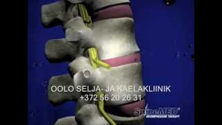 SELGROO DISKI DEKOMPRESSIOON EESTIS / KIROPRAKTIKA: SPINAL DISC DECOMPRESSION ESTONIA: NON-SURGICAL