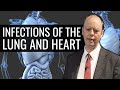 Infections of the Lung and Heart