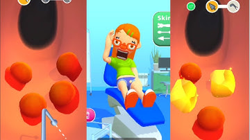 EarWax Clinic Game 3D New Max Level Gameplay Walkthrough Update Trailer iOS, Android Mobile Game
