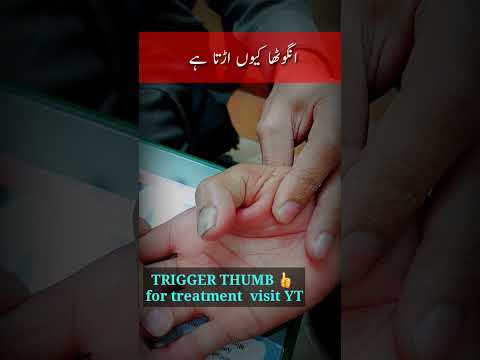 trigger thumb |