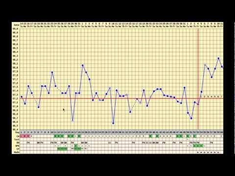 Pcos Bbt Chart