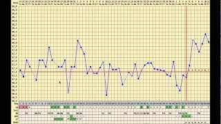 Pregnant with a boy, PCOS, long cycle, rocky temperatures