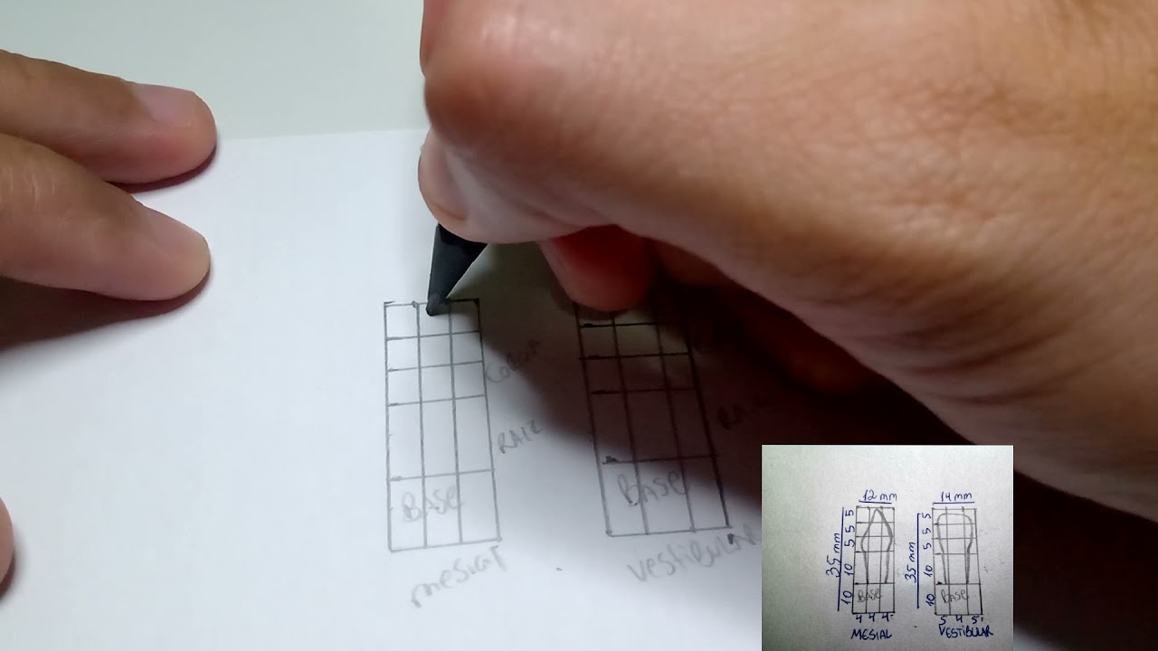 DESENHO DO INCISIVO CENTRAL 11